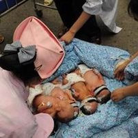 移植后乳房涨还是软好？